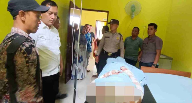 Cemburu Buta, Suami di Langkat Bakar Istri Sirinya