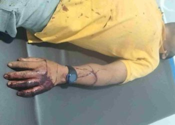 Dampak dari Korban yang di Bacok, Warga Pematang Tengah Desak Polisi Tangkap Seluruh Pelaku Penyerangan