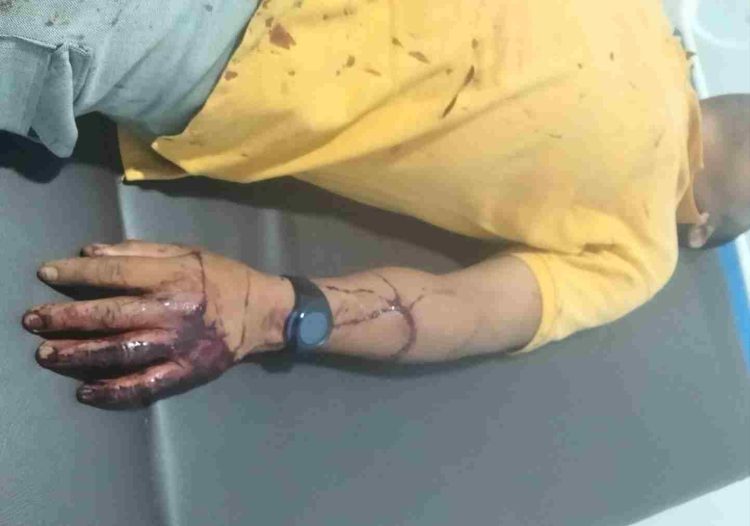 Dampak dari Korban yang di Bacok, Warga Pematang Tengah Desak Polisi Tangkap Seluruh Pelaku Penyerangan